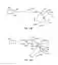 Fig. 33 - Methods for stimulating a dorsal root ganglion