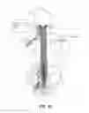 Fig. 40 - Methods for stimulating a dorsal root ganglion