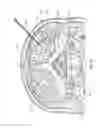 Fig. 45 - Methods for stimulating a dorsal root ganglion