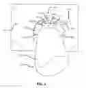Fig. 04 - Clamping Device