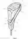 Fig. 02 - Headcovers having a collapsible configuration and methods to manufacture headcovers having a collapsible configuration