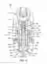 Fig. 05 - Fuel filter device