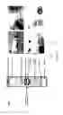 Fig. 06 - Filtration device for rapid separation of biological particles from complex matrices