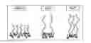 Fig. 01 - Surface-modified super absorbent resin and method for preparing same