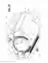 Fig. 12 - Applicator