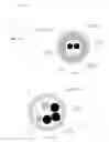 Fig. 16 - Medical devices having smoothly articulating multi-cluster joints