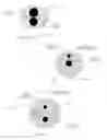 Fig. 19 - Medical devices having smoothly articulating multi-cluster joints