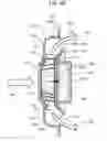 Fig. 10 - Temperature conditioning unit, temperature conditioning system, and vehicle provided with temperature conditioning unit