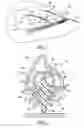 Fig. 02 - Wiper assembly, a windshield wiper apparatus and a method of reusing the wiper assembly