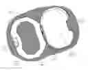 Fig. 08 - Closure assembly and method for opening