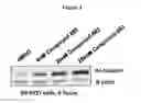 Fig. 04 - Pyrimidine hydroxy amide compounds as HDAC6 selective inhibitors