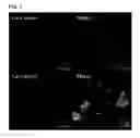 Fig. 02 - Derivatized corroles and metallocorroles and their use as imaging and therapeutic agents