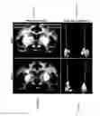 Fig. 02 - HTT repressors and uses thereof