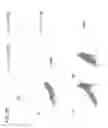 Fig. 09 - Optimized variants of anti-VEGF antibodies and methods of treatment thereof by reducing or inhibiting angiogenesis