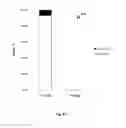 Fig. 49 - Animal models and therapeutic molecules
