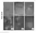 Fig. 07 - PRIMITIVE AND PROXIMAL HEPATIC STEM CELLS