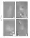 Fig. 09 - PRIMITIVE AND PROXIMAL HEPATIC STEM CELLS