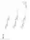 Fig. 15 - COAGULATION FACTOR VII POLYPEPTIDES