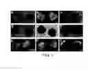 Fig. 02 - INHIBITING GENE EXPRESSION WITH dsRNA
