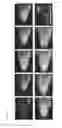 Fig. 07 - Lentiviral vectors