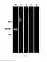 Fig. 07 - Isothermal nucleic acid amplification reactor with integrated solid state membrane