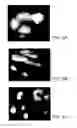 Fig. 03 - METHODS AND MATERIALS FOR DETECTING GENE AMPLIFICATION