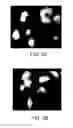Fig. 04 - METHODS AND MATERIALS FOR DETECTING GENE AMPLIFICATION