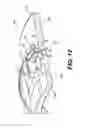 Fig. 14 - Compliant coupling systems and methods for shrouds
