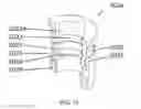 Fig. 18 - Double-crankshaft variable compression ratio engine