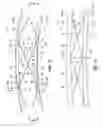 Fig. 09 - Sandwich structure having hinge assemblies for accommodating differential in-plane expansion of face sheets