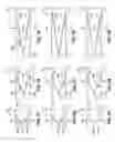 Fig. 31 - Sandwich structure having hinge assemblies for accommodating differential in-plane expansion of face sheets