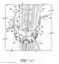 Fig. 06 - WIND TURBINE DRIP LOOP CABLE SECUREMENT ASSEMBLY