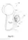 Fig. 03 - Resealing suction cup holding system