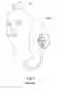 Fig. 05 - Resealing suction cup holding system