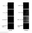 Fig. 56 - Covalent tethering of functional groups to proteins and substrates therefor