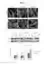 Fig. 10 - EARLY DETECTION OF PREECLAMPSIA
