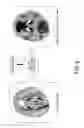 Fig. 10 - MRI apparatus, image processing apparatus, and image processing method