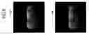 Fig. 10 - MAGNETIC RESONANCE IMAGING APPARATUS AND METHOD FOR GENERATING WATER-FAT SEPARATION IMAGE