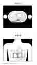Fig. 05 - Magnetic resonance imaging apparatus and method controlling execution of a pulse sequence based on recovery of longitudinal magnetization of a monitor region
