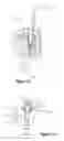 Fig. 05 - Locking mechanism