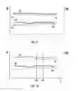 Fig. 08 - Physiology-based selection of performance enhancing music