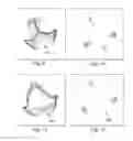 Fig. 04 - Determining an effective cross-sectional area of a cardiovascular structure