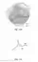 Fig. 06 - Determining an effective cross-sectional area of a cardiovascular structure
