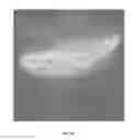 Fig. 07 - Methods and systems for image analysis using non-euclidean deformed graphs