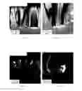 Fig. 19 - ARTICLE AND PROCESS FOR SELECTIVE ETCHING