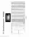 Fig. 22 - Light emitting diode devices with zinc oxide layer