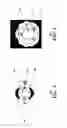 Fig. 03 - Communication device and antenna assembly with actuated gimbal mount