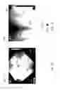 Fig. 14 - Structures and methods for thermal management in printed circuit board stators