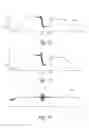 Fig. 10 - Autofocus method for microscope and microscope comprising autofocus device
