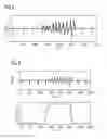 Fig. 04 - Method and device for detecting bioelectric signals